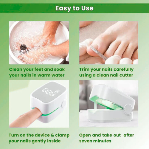 Emberlei™ - Nail Fungus Laser